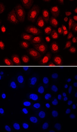 Human MSX2 Antibody, R D Systems 25&mu;g; Unlabeled:Antibodies, Monoclonal