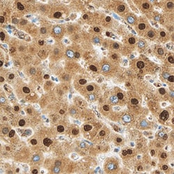Human MTF2 Antibody, R D Systems 100&mu;g; Unlabeled:Antibodies, Polyclonal
