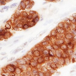 Human MUC-1 Antibody, R D Systems 100ug; Unlabeled:Antibodies, Monoclonal