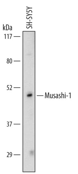 Human Musashi-1 Antibody, R D Systems 25&mu;g; Unlabeled:Antibodies, Monoclonal