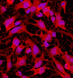Human Musashi-2 Antibody, R D Systems 25&mu;g; Unlabeled:Antibodies, Polyclonal