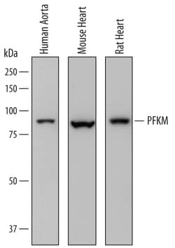 Human/Mouse/Rat Muscle Phosphofructokinase/PFKM Antibody, R D Systems 100&mu;g;