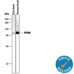 Human/Mouse/Rat Muscle Phosphofructokinase/PFKM Antibody, R D Systems 100ug;