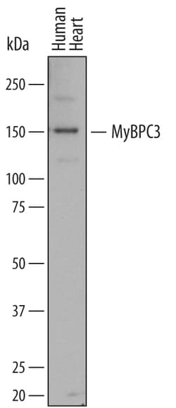 Human MyBPC3 Antibody, R D Systems 25 &mu;g | Buy Online | R&D Systems | Fisher Scientific