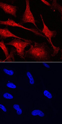 MYCL1/L-Myc Goat anti-Human, Mouse, Polyclonal, R D Systems 100&mu;g; Unlabeled:Antibodies,