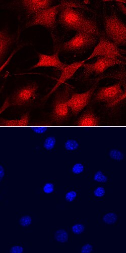 MYCL1/L-Myc Goat anti-Human, Mouse, Polyclonal, R D Systems 100&mu;g; Unlabeled:Antibodies,