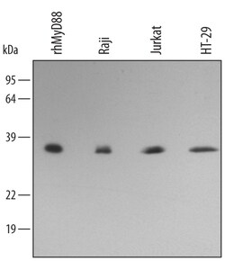 Human MyD88 Antibody, R D Systems 25&mu;g; Unlabeled:Antibodies, Polyclonal