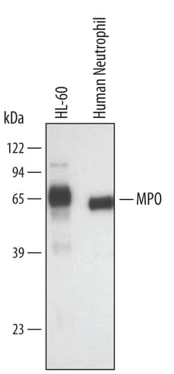 Human Myeloperoxidase/MPO Antibody, R D Systems 100 &mu;g | Buy Online | R&D Systems | Fisher Scientific