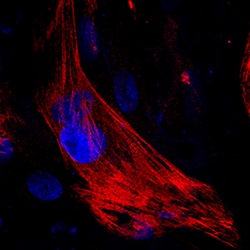 Human MYH6 Antibody, R D Systems 100&mu;g; Unlabeled:Antibodies, Monoclonal