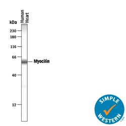 Human Myocilin Antibody, R D Systems 25&mu;g; Unlabeled:Antibodies, Polyclonal