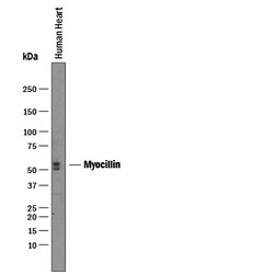 Human Myocilin Antibody, R D Systems 25&mu;g; Unlabeled:Antibodies, Polyclonal