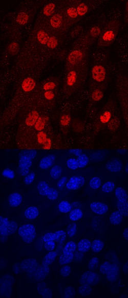 Human/Mouse Myogenin Antibody, R D Systems 100ug; Unlabeled:Antibodies,