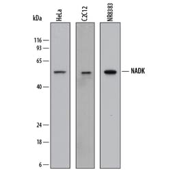 Human/Mouse/Rat NADK Antibody, R D Systems 100 &mu;g | Buy Online | R&D Systems | Fisher Scientific