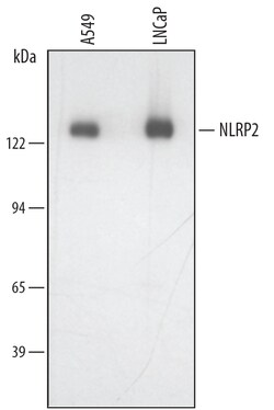 Human NLRP2/NALP2 Antibody, R D Systems 25&mu;g; Unlabeled:Antibodies,