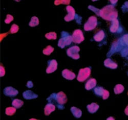 Human Nanog Antibody, R D Systems 50&mu;g; Unlabeled:Antibodies, Polyclonal