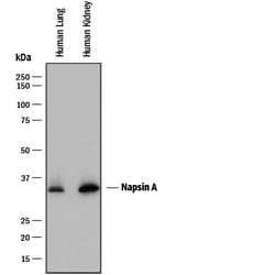 Human Napsin A Antibody, R D Systems 100&mu;L:Antibodies, Polyclonal