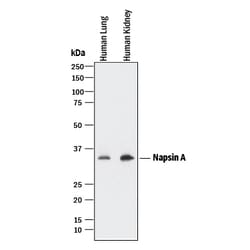Human Napsin A Antibody, R D Systems 25 &mu;g | Buy Online | R&D Systems | Fisher Scientific