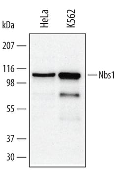 Human Nbs1 Antibody, R D Systems 100&mu;g; Unlabeled:Antibodies, Polyclonal