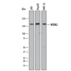 Human NCOA2 Antibody, R D Systems 25&mu;g; Unlabeled:Antibodies, Polyclonal