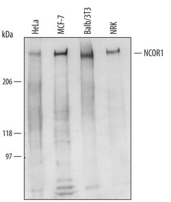 Human/Mouse/Rat NCOR1 Antibody, R D Systems 25&mu;g; Unlabeled:Antibodies,
