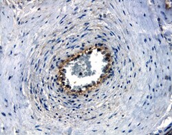Human Nectin-4 Antibody, R D Systems 100&mu;g; Unlabeled:Antibodies, Polyclonal