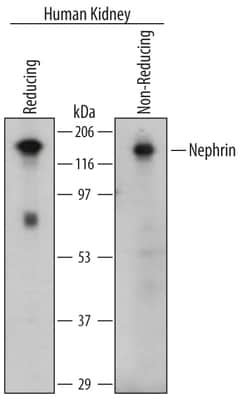Human Nephrin Antibody, R D Systems 25&mu;g; Unlabeled:Antibodies, Polyclonal