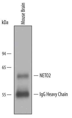 Human/Mouse NETO2 Antibody, R D Systems 25&mu;g; Unlabeled:Antibodies,