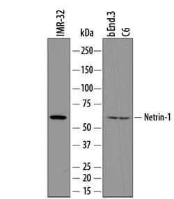 Human/Mouse/Rat Netrin-1 Antibody, R D Systems 25&mu;g; Unlabeled:Antibodies,