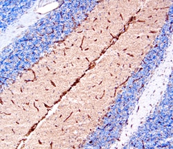 Mouse Netrin-4 Antibody, R D Systems 100&mu;g; Unlabeled:Antibodies, Polyclonal
