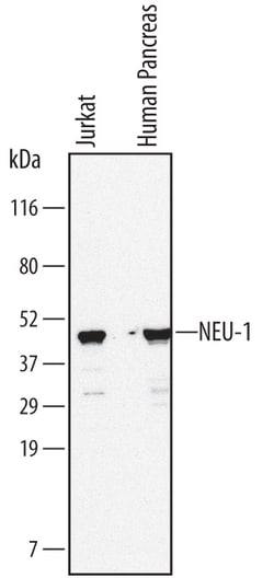 Human NEU-1/Sialidase-1 Antibody, R D Systems 100ug; Unlabeled:Antibodies,
