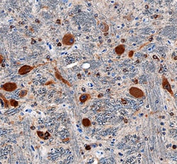 Human Neudesin Antibody, R D Systems 100ug; Unlabeled:Antibodies, Monoclonal