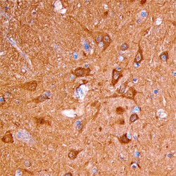 Human Neurocan Antibody, R D Systems 25&mu;g; Unlabeled:Antibodies, Polyclonal
