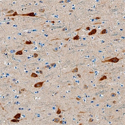 Human/Mouse/Rat Neurogranin Antibody, R D Systems 100ug; Unlabeled:Antibodies,