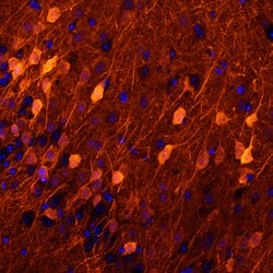 Human/Mouse/Rat Neurogranin Antibody, R D Systems 100ug; Unlabeled:Antibodies,