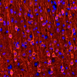 Human/Mouse/Rat Neurogranin Antibody, R D Systems 100ug; Unlabeled:Antibodies,