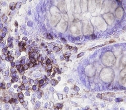 Human Neuromedin BR/NMBR Antibody, R D Systems 100ug; Unlabeled:Antibodies,