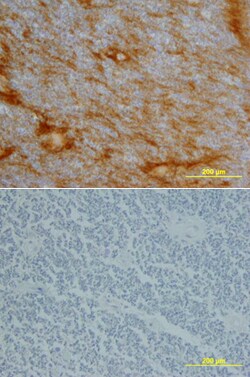 Human Neurotrimin Biotinylated Antibody, R D Systems 50&mu;g; Biotin:Antibodies,