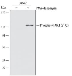 Human Phospho-NFATC1 (S172) Antibody, R D Systems 25&mu;g; Unlabeled:Antibodies,