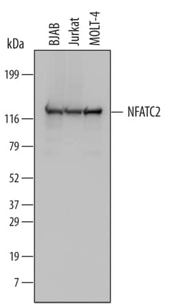 Human NFATC2 Antibody, R D Systems 100ug; Unlabeled:Antibodies, Monoclonal