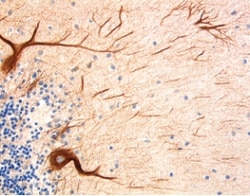 Human NF-H Antibody, R D Systems 100&mu;g; Unlabeled:Antibodies, Polyclonal