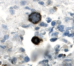 Human NG2/MCSP Antibody, R D Systems 100ug; Unlabeled:Antibodies, Monoclonal
