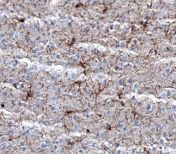 Mouse NG2/MCSP Antibody, R D Systems 100ug; Unlabeled:Antibodies, Monoclonal