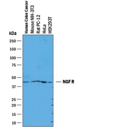 Human NGFR/TNFRSF16 Antibody, R D Systems 25&mu;g; Unlabeled:Antibodies,