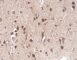 Human/Canine NGFR/TNFRSF16 Antibody, R D Systems 100ug; Unlabeled:Antibodies,