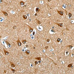 Human NGL-1/LRRC4C Antibody, R D Systems 25&mu;g; Unlabeled:Antibodies,