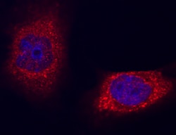 Human Niemann-Pick Type C2/NPC2 Antibody, R D Systems 25 &mu;L | Buy Online | R&D Systems | Fisher Scientific