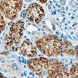 Human Niemann-Pick Type C2/NPC2 Antibody, R D Systems 25 &mu;L | Buy Online | R&D Systems | Fisher Scientific