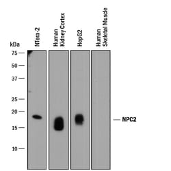 Human Niemann-Pick Type C2/NPC2 Antibody, R D Systems 25 &mu;L | Buy Online | R&D Systems | Fisher Scientific