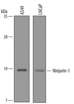 Human Ninjurin-1 Antibody, R D Systems 100&mu;g; Unlabeled:Antibodies,