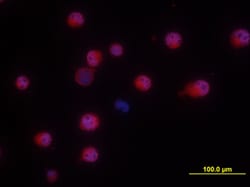 Human NKp46/NCR1 Antibody, R D Systems 25&mu;g; Unlabeled:Antibodies, Polyclonal